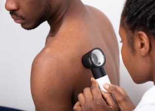 Dermatologist - Dermatologist examining skin with dermatoscope during check-up.